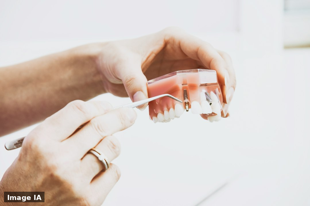 Comprendre les postes dentaires: soins, prothèses, implants, parodontologie